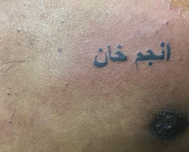Name 